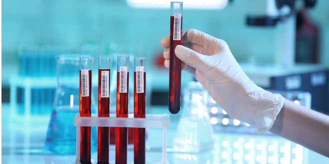 анализ крови