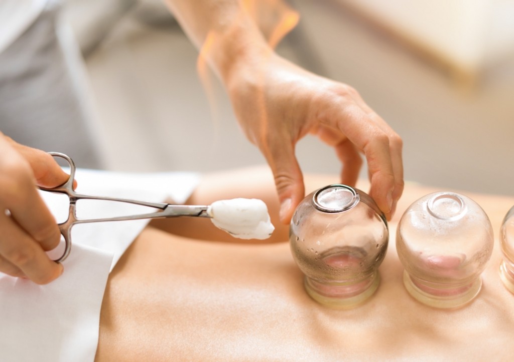 Процесс установки банок на спину