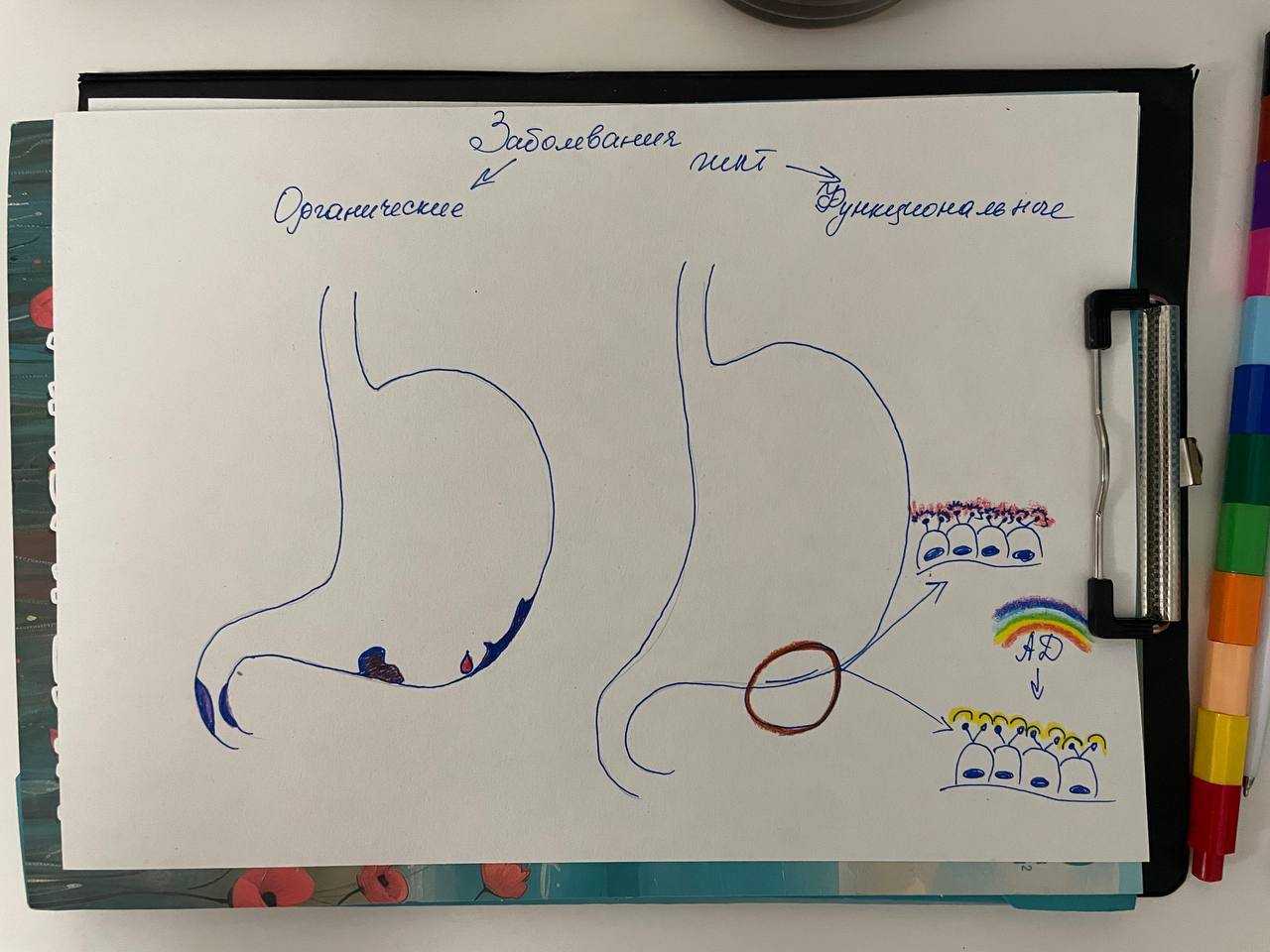 Градация заболеваний ЖКТ