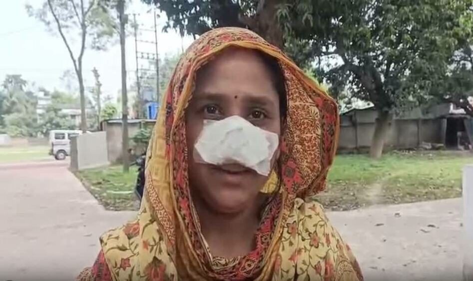 Муж откусил нос из ревности