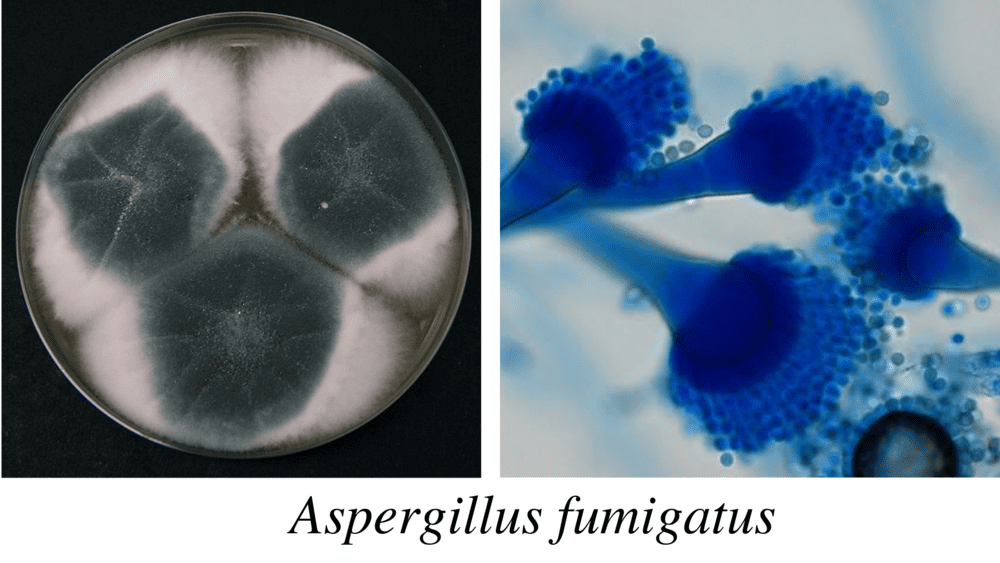 Aspergillus-fumigatus