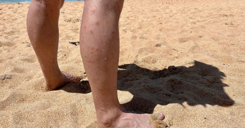 В турции заразились вирусом 15 туристов