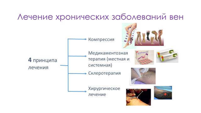 Тактика лечения варикоза