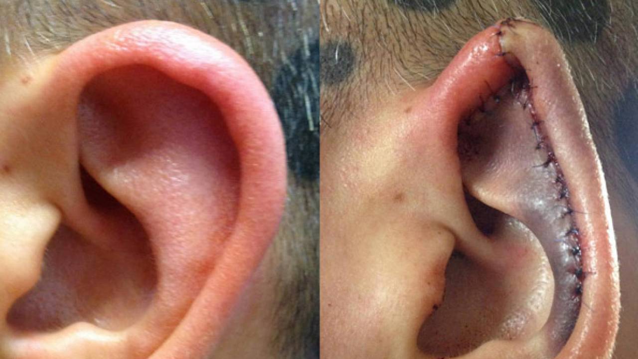 Эльфийские уши