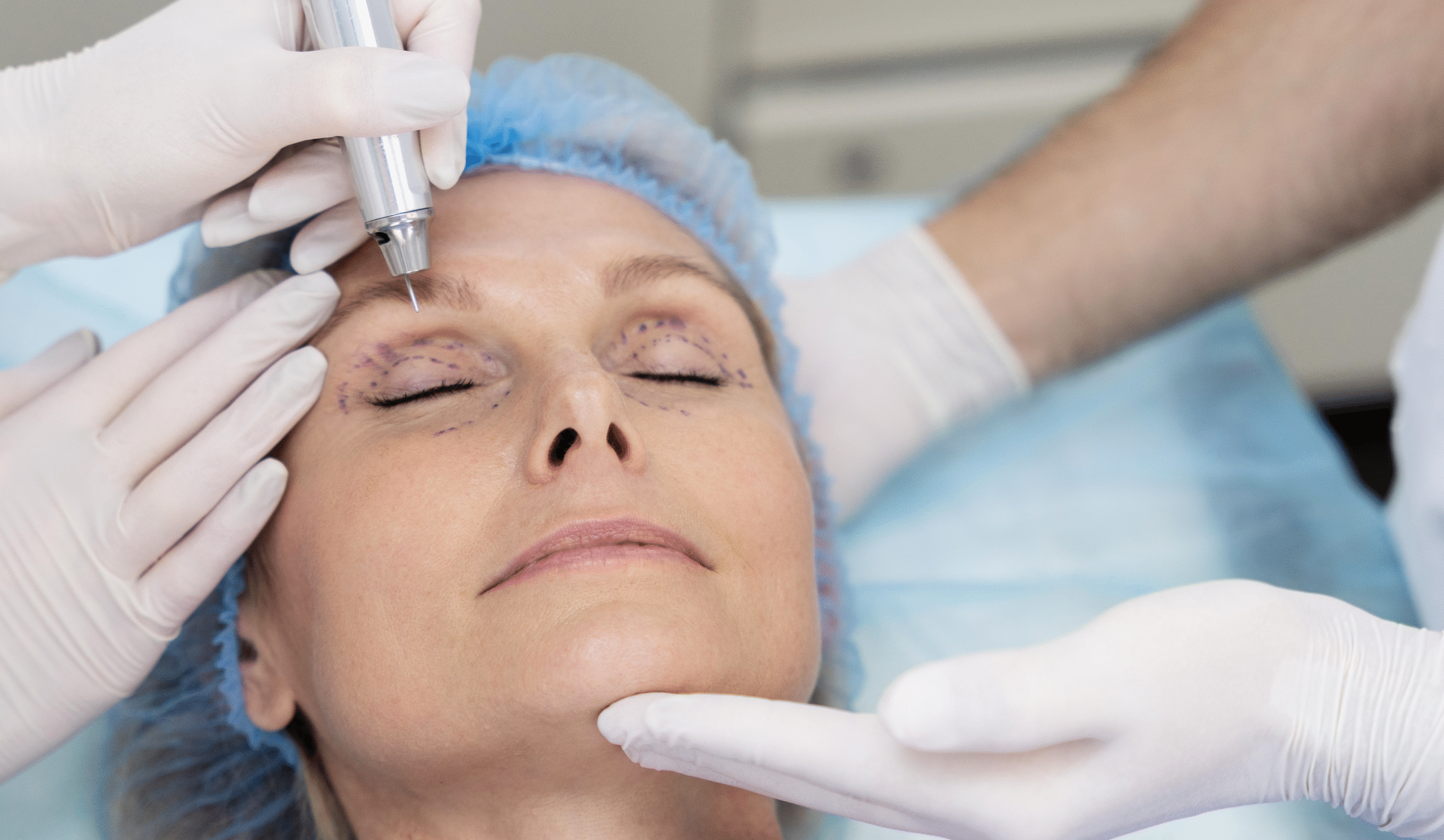 Пластическая операция