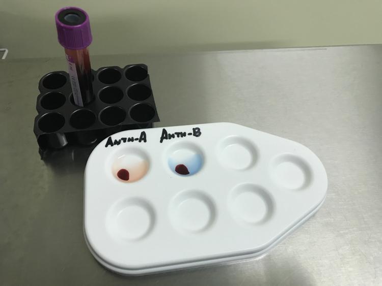 Группы крови