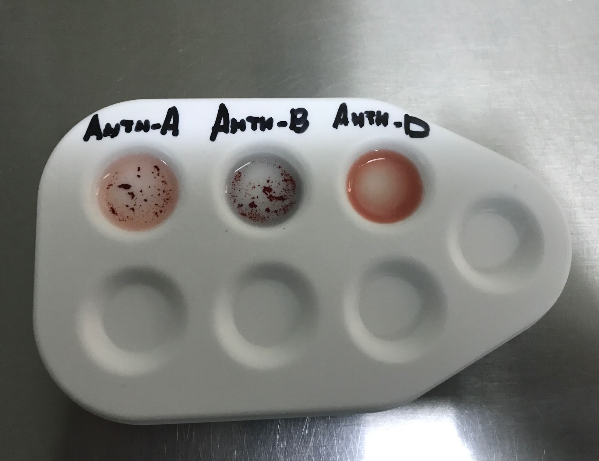 определение группы крови