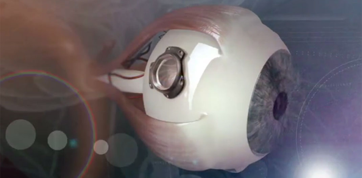 Ретинальные импланты